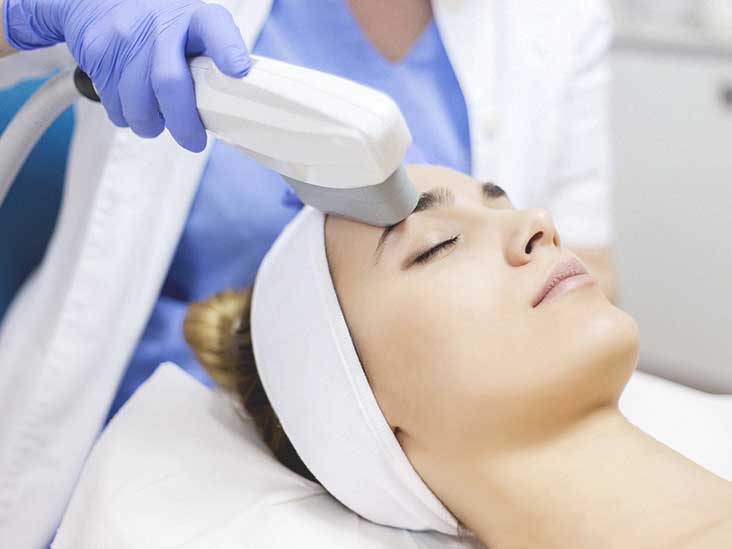 IPL PHOTOREJUVENATION FACIAL (Luz Pulsada Rejuvenecimiento Facial)